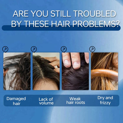 15ML Scalpy Hair Growth Serum for Men & Women Scalp Treatment - My Charm Corner