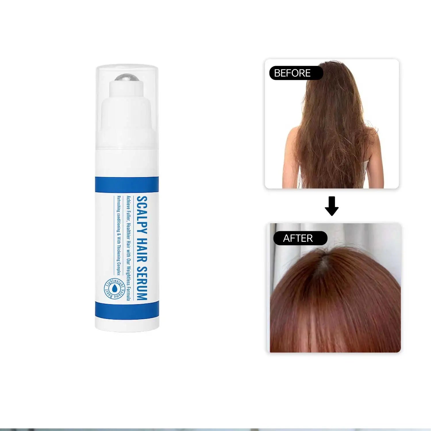 15ML Scalpy Hair Growth Serum for Men & Women Scalp Treatment - My Charm Corner