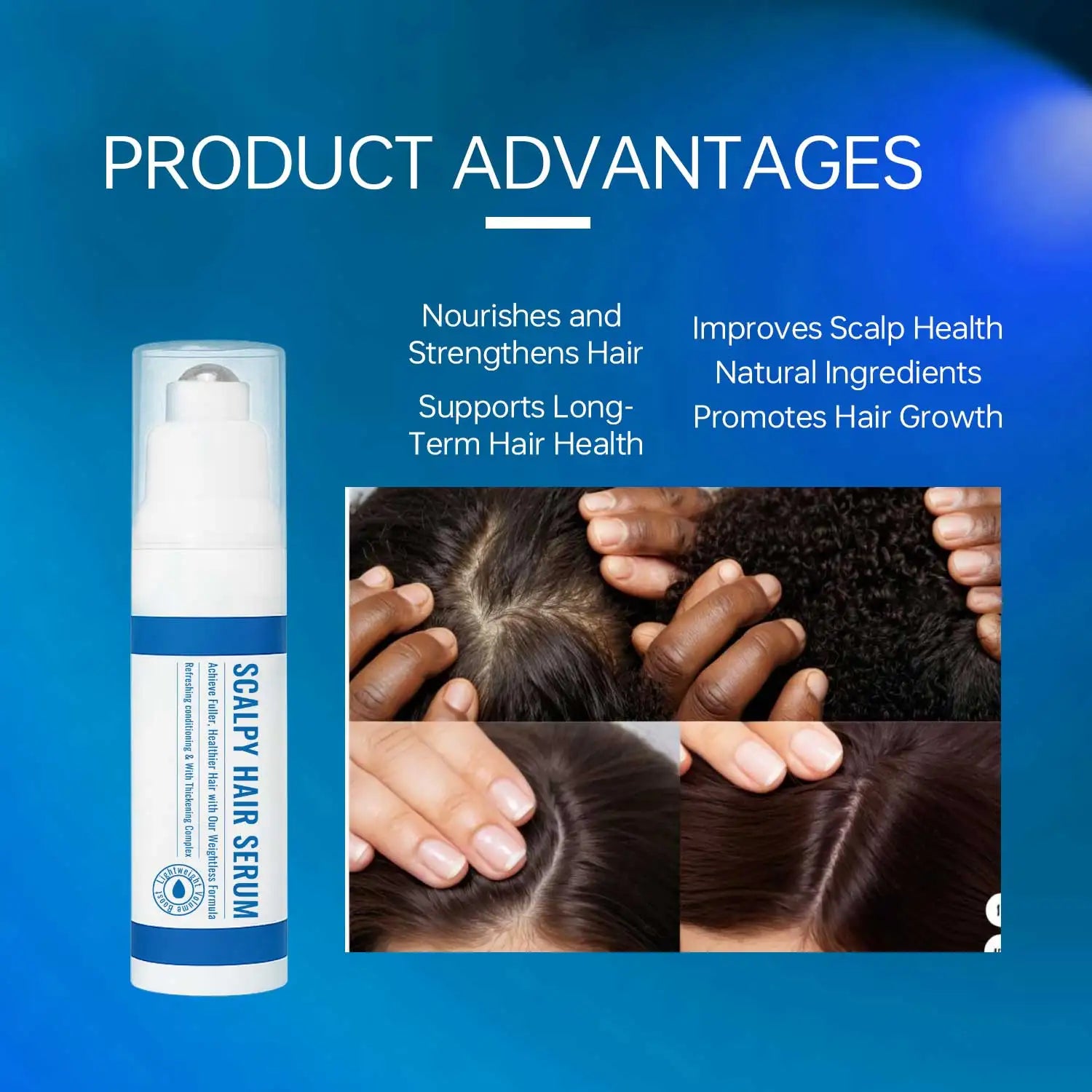 15ML Scalpy Hair Growth Serum for Men & Women Scalp Treatment - My Charm Corner